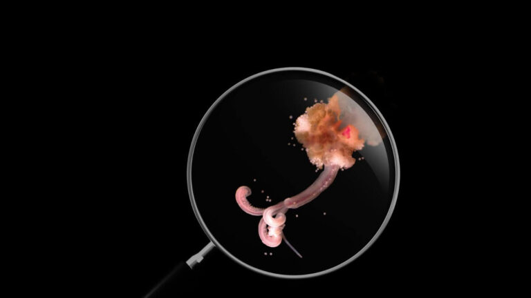 image of a zombie worm being looked at through a magnifying glass